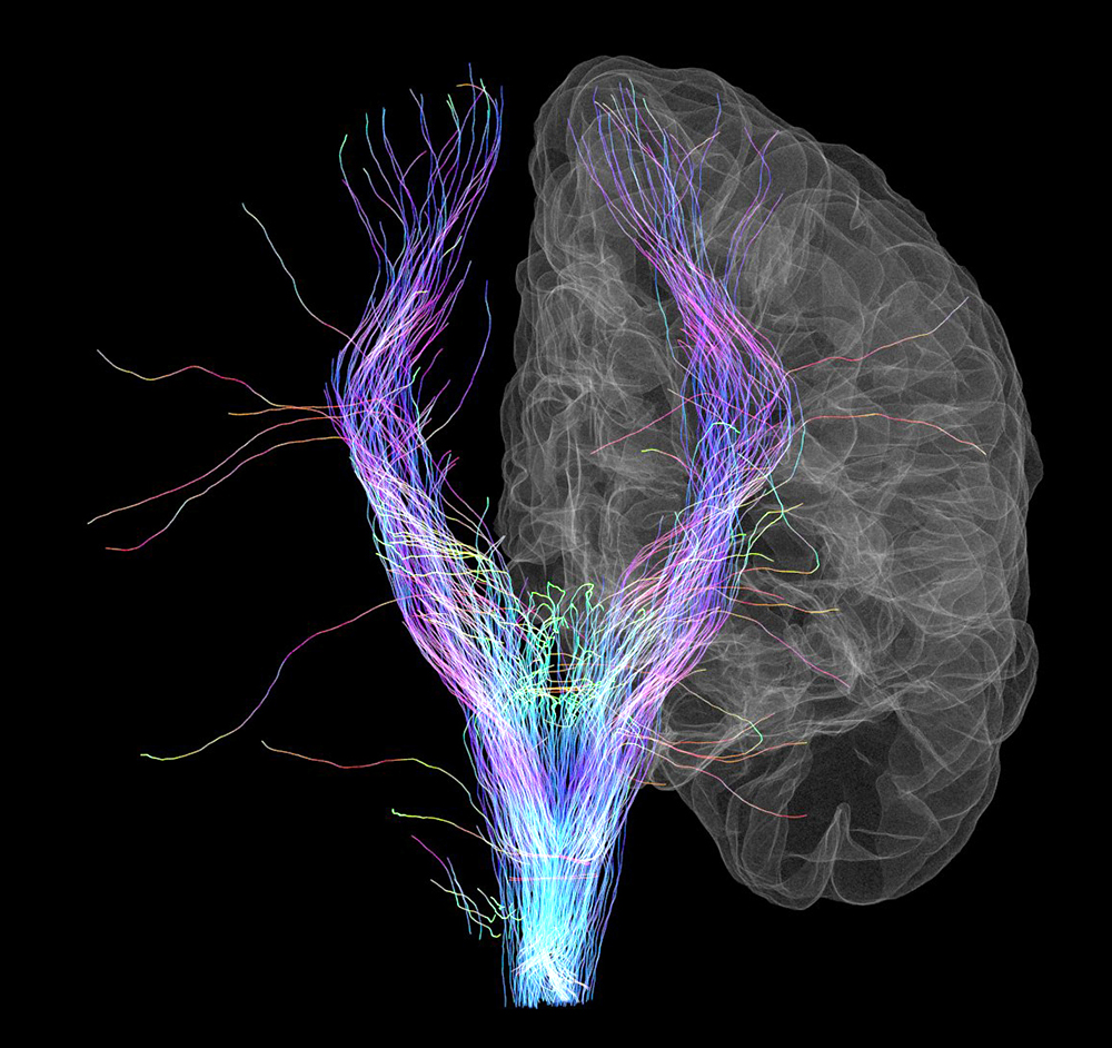 USC Mark and Mary Stevens Neuroimaging and Informatics Institute